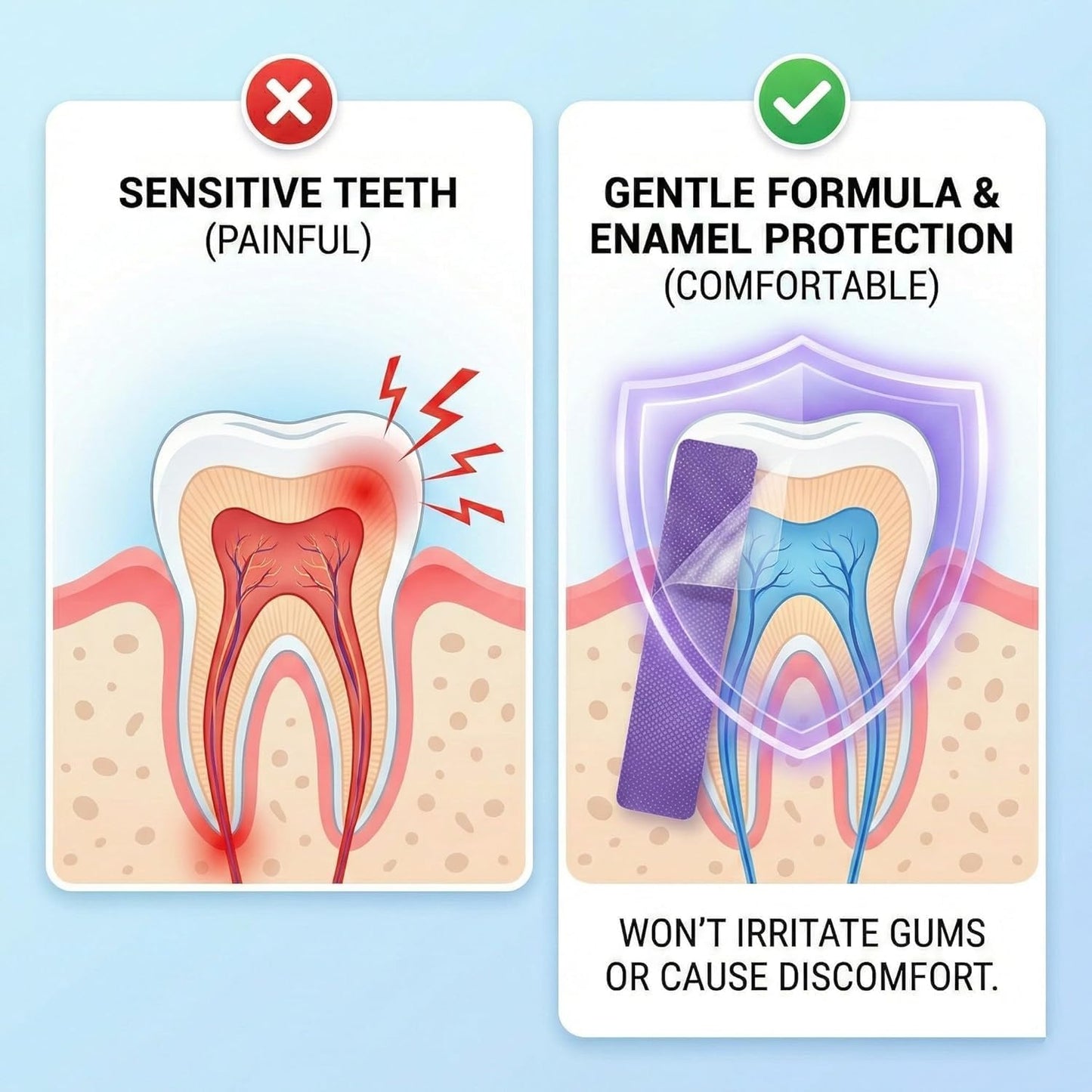 Teeth Whitening Strips