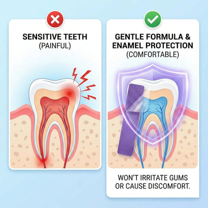 Teeth Whitening Strips